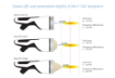 Picture of INTELECT FOCAL SHOCKWAVE SET - CHATTANOOGA